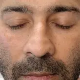 eye-dark